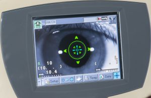 Síntomas de la retinopatía diabética1